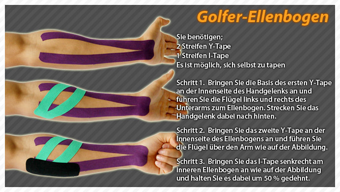 clinical taping-golf elbow